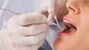 Restorative Dentistry